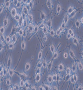 MADB106大鼠乳腺癌細胞主圖