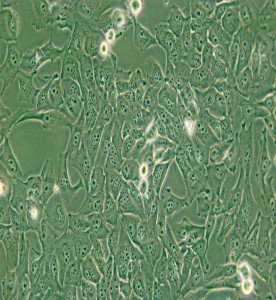 KMH-2人甲狀腺癌細胞主圖