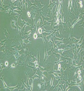 KYSE-410人食管鱗癌細(xì)胞主圖