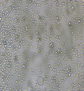 L6565小鼠白血病克隆細胞系主圖