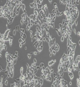 LS-174T人結腸腺癌細胞主圖