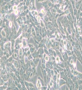 NCI-H295R人腎上腺皮質(zhì)腺癌細(xì)胞主圖