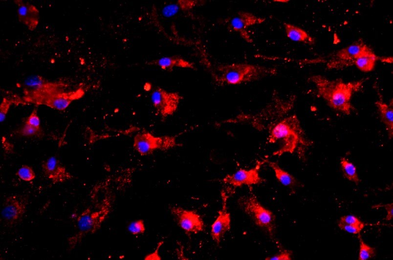 大鼠肺微血管內皮細胞主圖