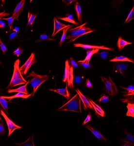 大鼠結(jié)腸平滑肌細(xì)胞主圖