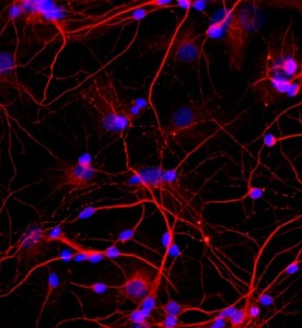 大鼠海馬神經元細胞主圖