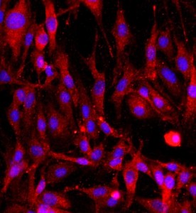 大鼠海綿體內(nèi)皮細胞主圖