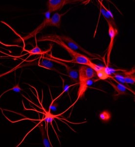 大鼠神經(jīng)星形膠質(zhì)細胞主圖