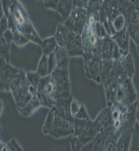 NCI-H1395人肺腺癌細胞主圖