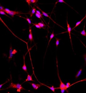 大鼠脊髓神經元細胞主圖