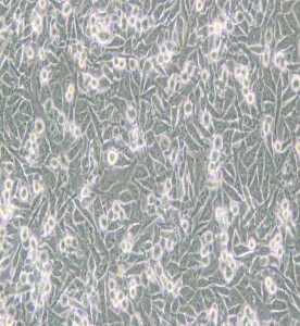 PaTu 8988t人胰腺癌細(xì)胞主圖