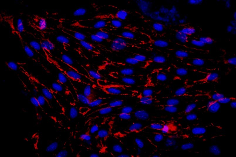 小鼠肺大動脈內(nèi)皮細(xì)胞主圖