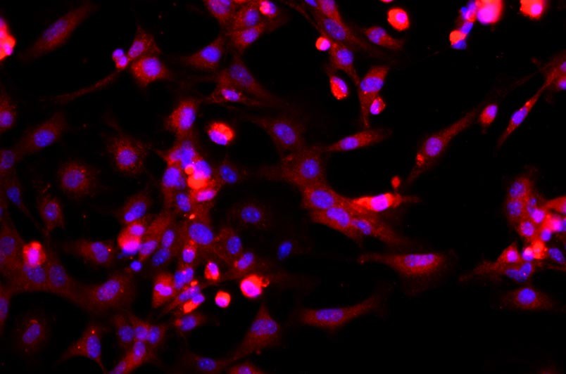 小鼠骨骼肌細胞主圖