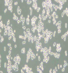 COLO-320DM人結直腸腺癌細胞主圖