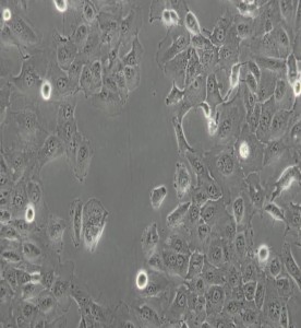 DU-145人前列腺癌細胞主圖