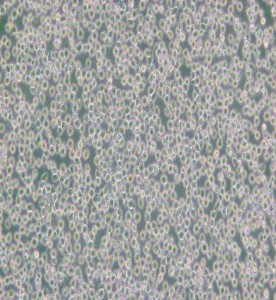 HAL-01人淋巴細胞白血病細胞主圖