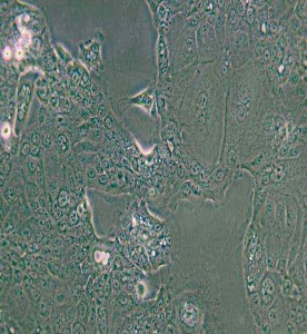 HPAF-II人胰腺癌細胞主圖