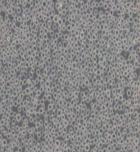 K-562人慢性髓原白血病細胞主圖