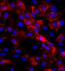 人臍靜脈內皮細胞主圖