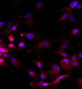 人椎間盤髓核細(xì)胞主圖