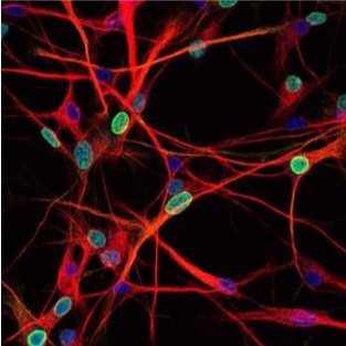 TUNEL（熒光）檢測(cè)主圖